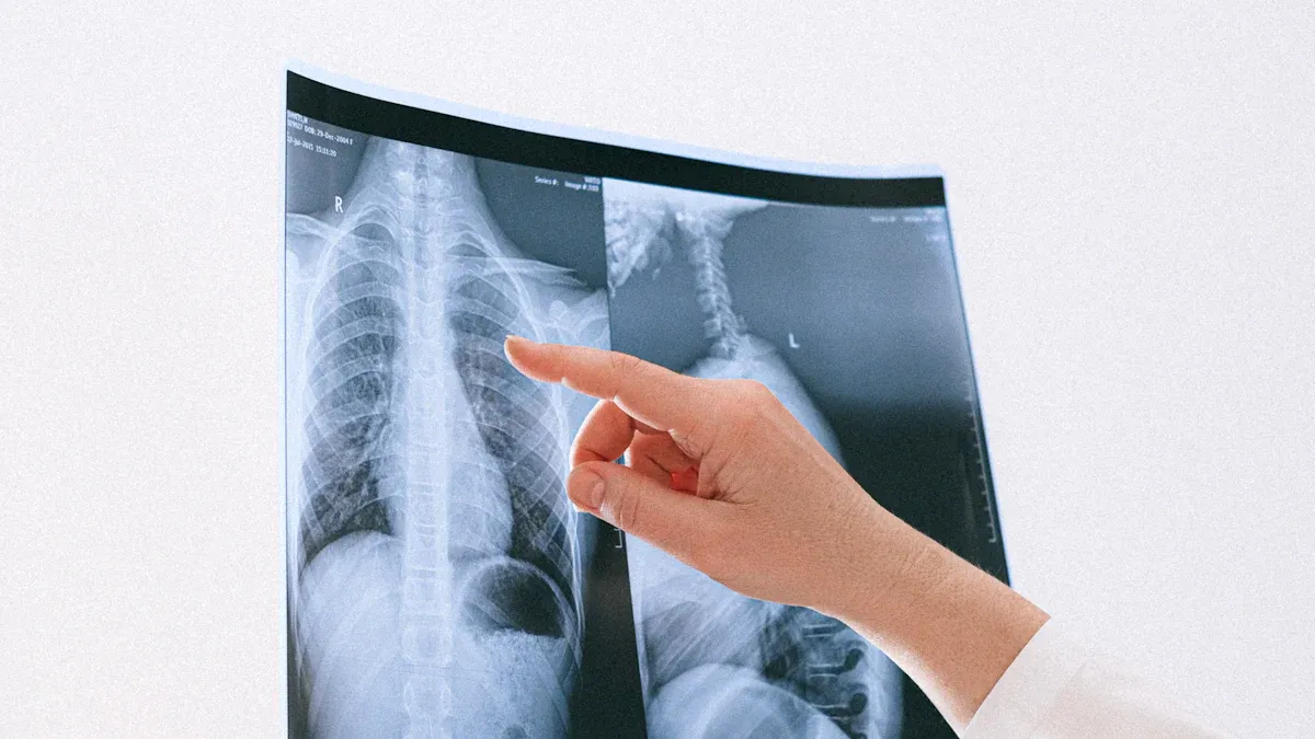 Discovery of X-Rays