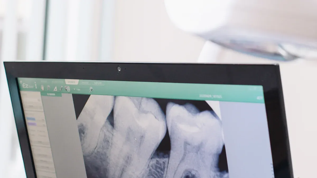 X-Ray Advancements